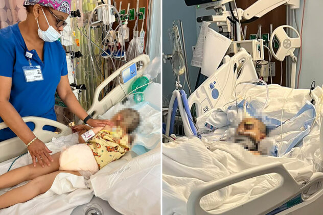 Battered 5-year-old son of NYC hammer attack victim suffering from ‘temporary amnesia’ but out of ICU