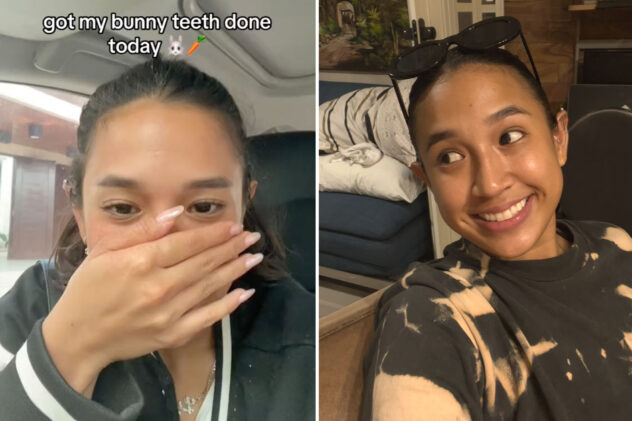 I spent $160 on bunny teeth — I love them but haters call me ugly
