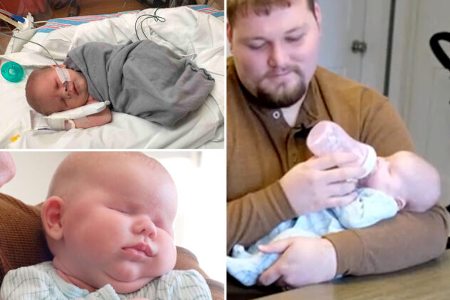 Couple’s baby born without eyes due to genetic disorder less common than ‘winning the Powerball’