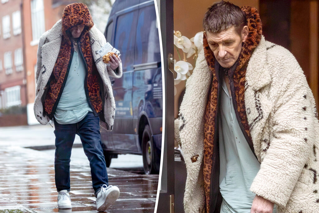 Disheveled ‘Peaky Blinders’ star Paul Anderson looks unrecognizable in new photos
