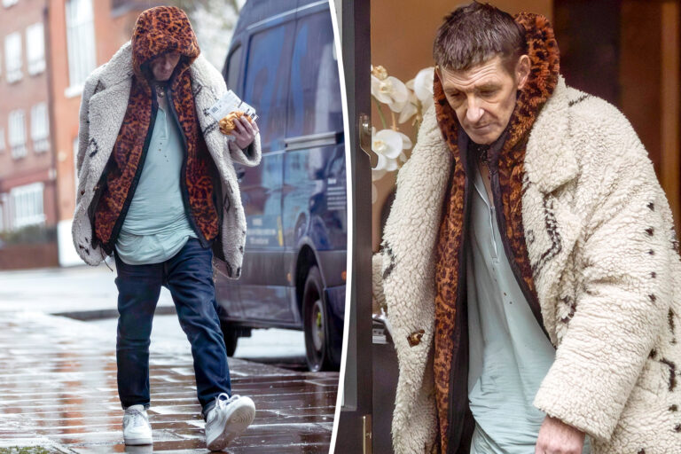 Disheveled ‘Peaky Blinders’ star Paul Anderson looks unrecognizable in new photos
