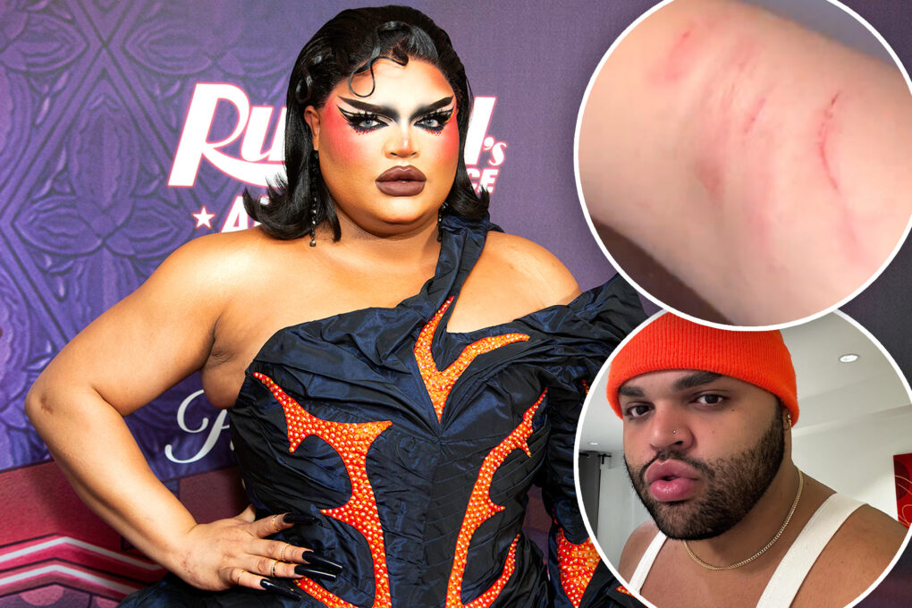 ‘RuPaul’s Drag Race’ alum Kandy Muse assaulted at club: ‘NO IS NO!’