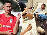World's richest footballer - whose family is worth £16bn - is hospitalised after suffering nasty leg injury during top-flight Thai League clash