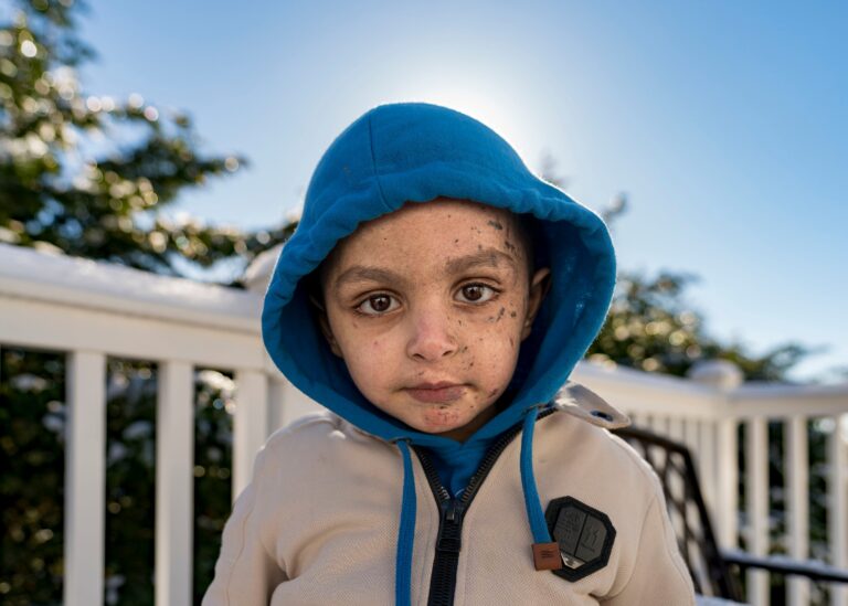 A 4-year-old Gaza boy lost his arm – and his family. Half a world away, he’s getting a second chance