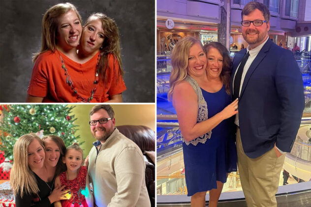 Can conjoined TLC stars Abby and Brittany Hensel have kids?