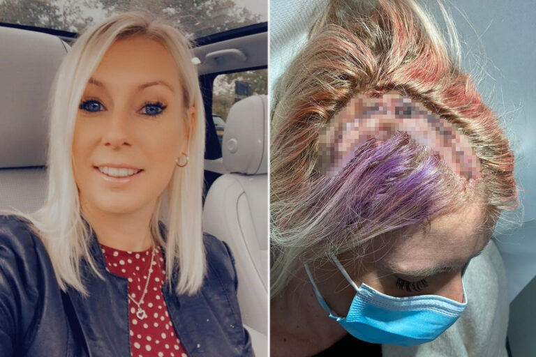 My doctor thought my pain was simply migraines— it was a brain tumor