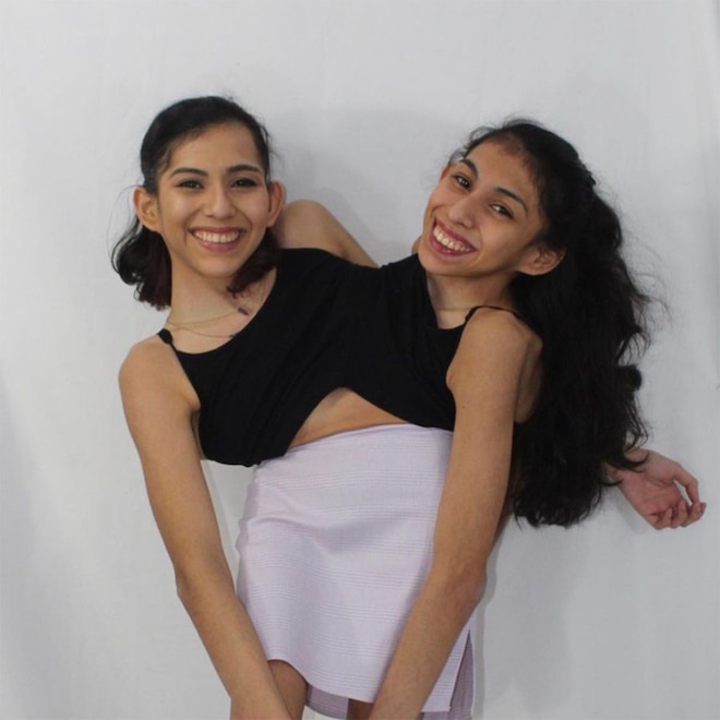 Conjoined Twin TikTokers Carmen & Lupita Slam “Disingenuous” Comments