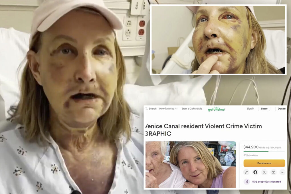 Crazed homeless man brutally beats two woman in Venice, Calif., leaving one in coma