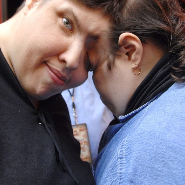 World's Oldest Conjoined Twins Lori and George Schappell Dead at 62