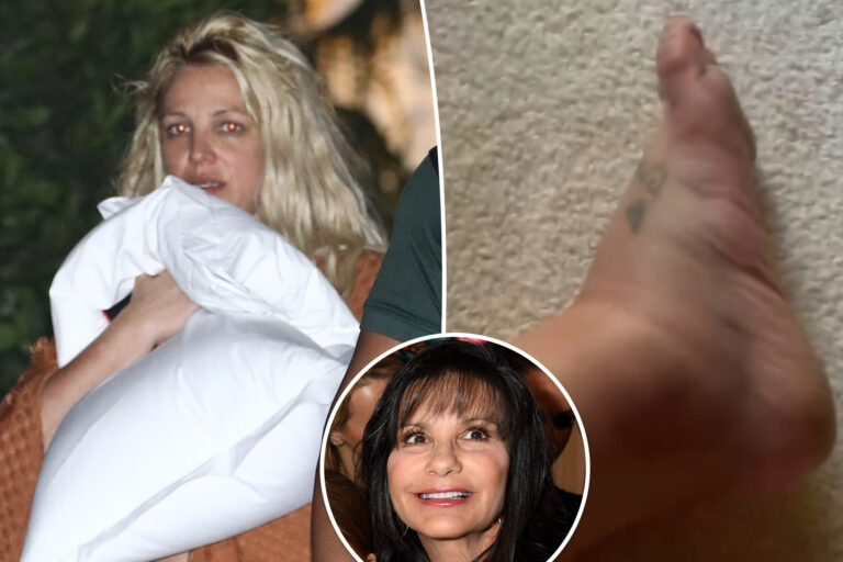 Britney Spears shows off bruised and swollen foot, seemingly blames mom for hotel drama