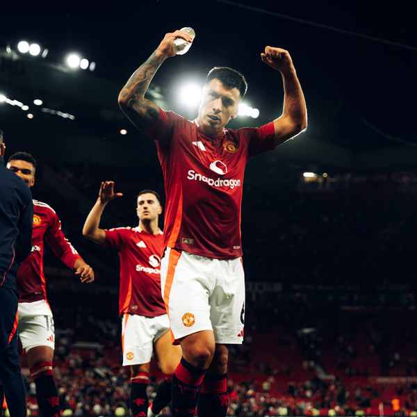 Fantasy United: What is your strategy v Brighton?