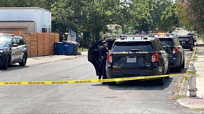 Man hospitalized in critical condition after he was shot in head, SAPD says