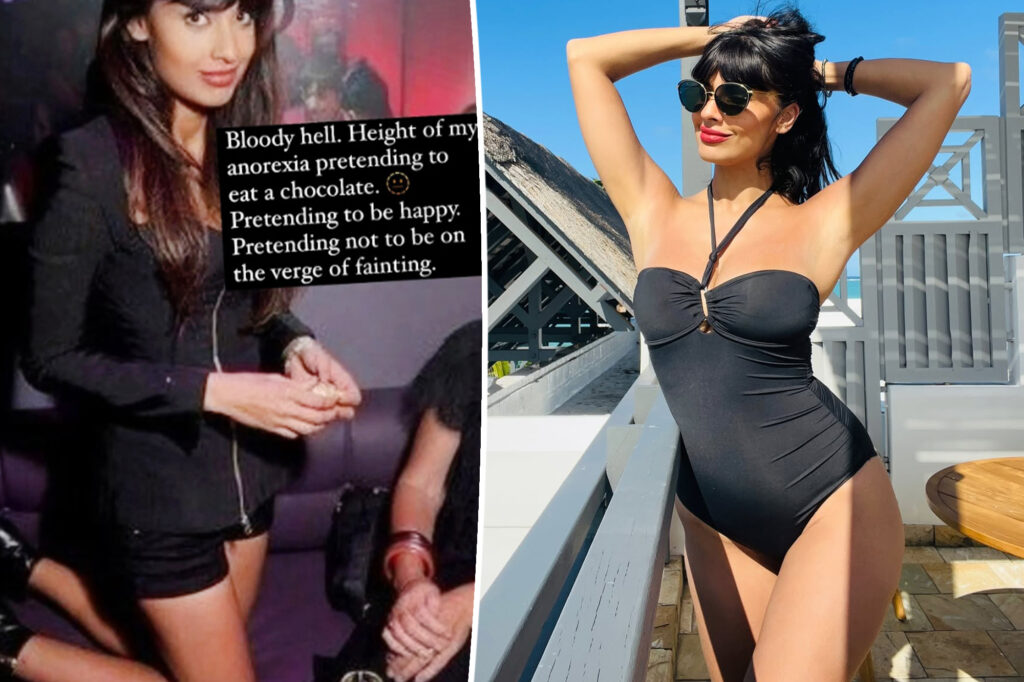 Jameela Jamil sounds off on ‘era of Ozempic heroin chic’ after overcoming eating disorder
