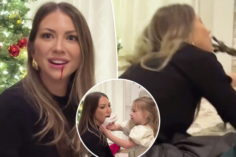 Stassi Schroeder gets a bloody lip after daughter, 3, accidentally hits her with a toy broom: ‘Is it really that bad?’