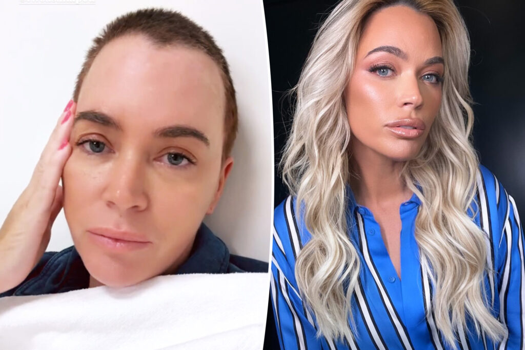 Teddi Mellencamp admittedly feels ‘very alone’ during cancer battle as she shares heartbreaking before-and-after pics