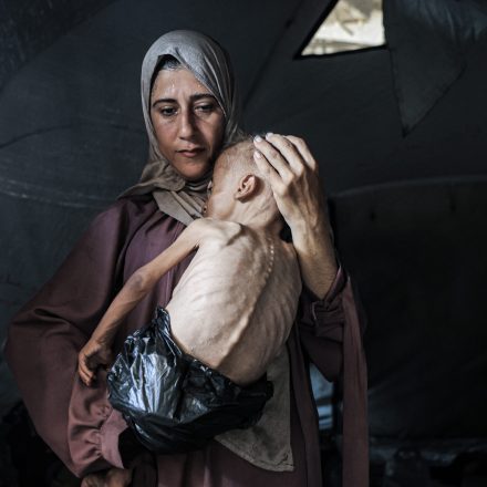 “Food Has Become a Memory”: My Hunger Diary in Gaza