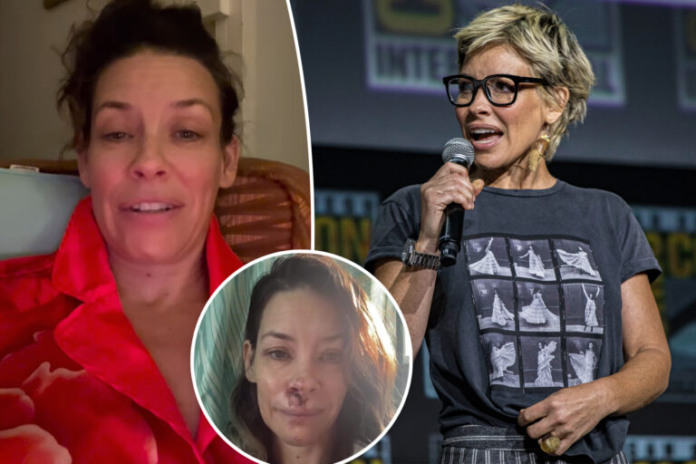 Evangeline Lilly shares devastating brain injury months after falling face-first on boulder