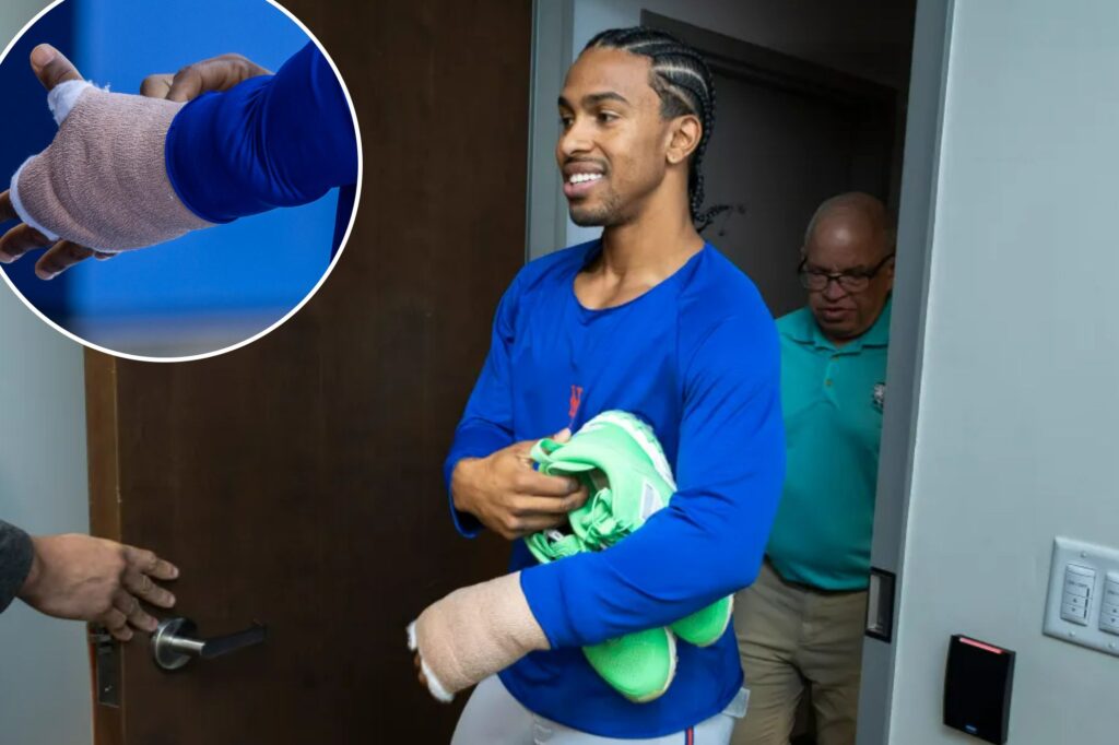 Francisco Lindor ‘very optimistic’ about his Mets Opening Day status after hand surgery