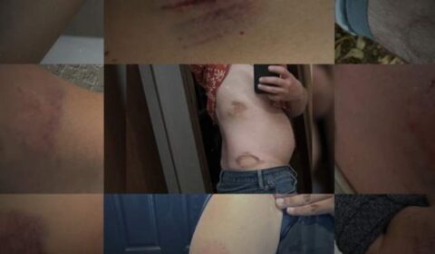 ‘I can’t physically do it anymore’: Data shows nearly 8,000 student-caused injuries reported by Bexar County educators