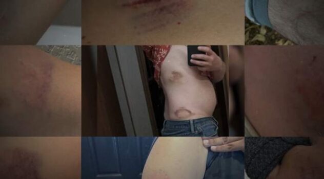 ‘I can’t physically do it anymore’: Data shows nearly 8,000 student-caused injuries reported by Bexar County educators