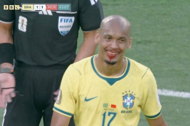 Fabinho left covered in blood at FIFA World Cup as ex-Liverpool star ordered off pitch