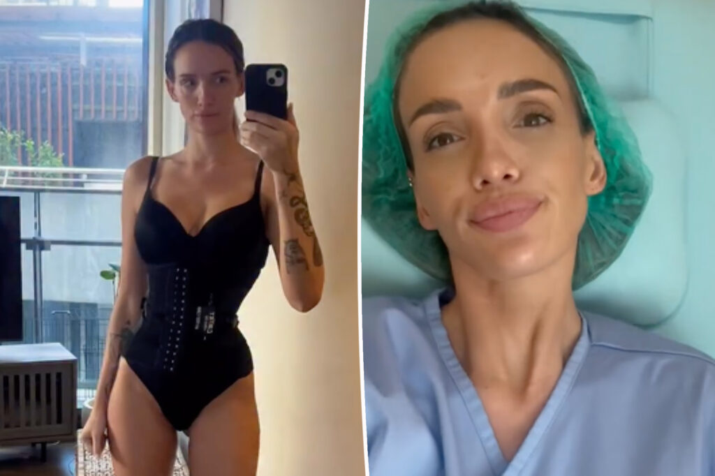 Bravo alum shares results of ‘rib recontouring’ procedure to get ‘snatched waist’: ‘Best thing I’ve done’