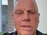 Former Man City captain, 56, gives positive health update after being diagnosed with devastating neurological condition as he returns to co-commentary work