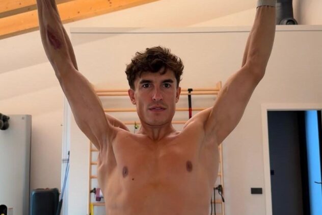 Marc Marquez shares shocking image of his right arm